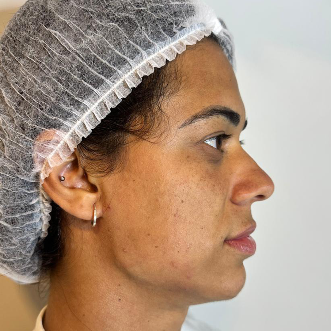 depoimento depois 1 copiar1 depoimento depois 1 copiar1