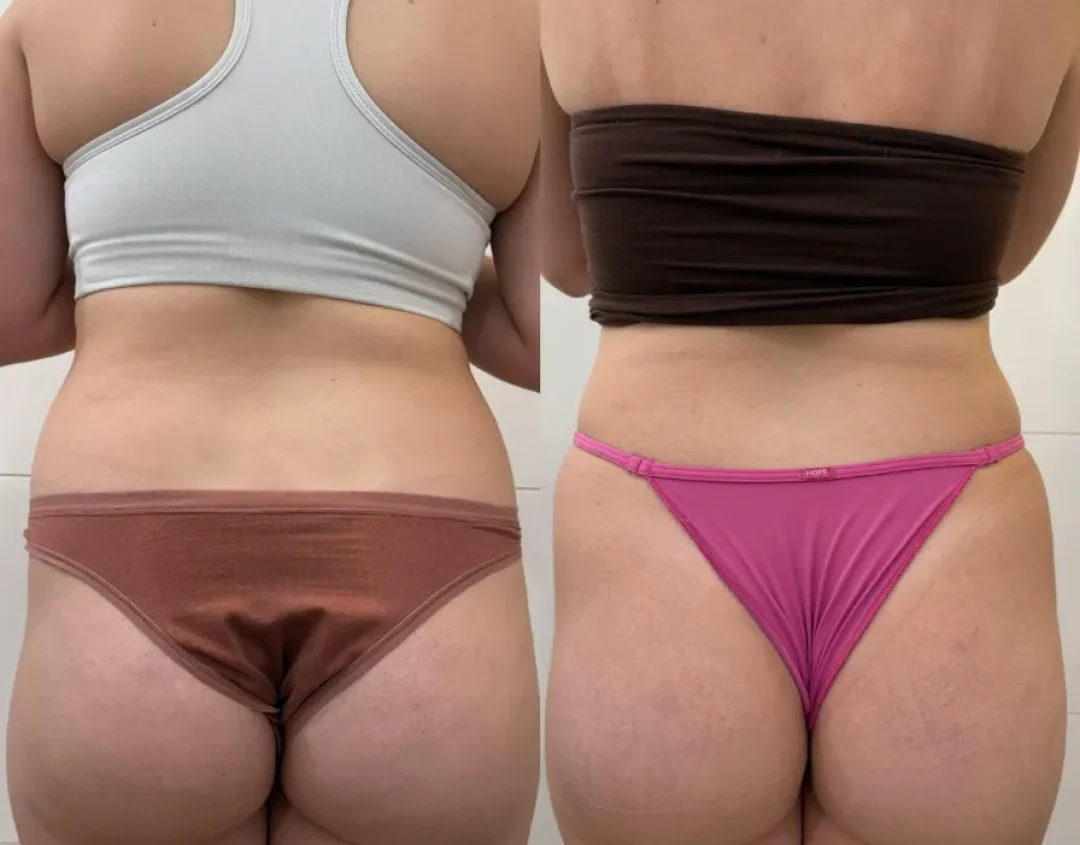 WhatsApp Image 2026-01-08 at 15.50.53 WhatsApp Image 2026-01-08 at 15.50.53