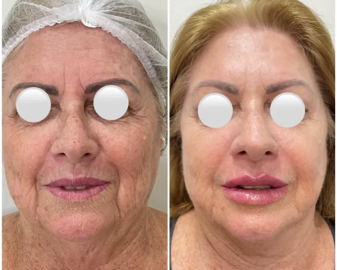 WhatsApp Image 2026-01-08 at 16.33.23 WhatsApp Image 2026-01-08 at 16.33.23